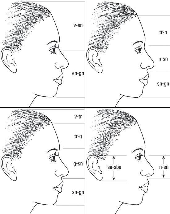 The facial proportions involved in the four vertical neoclassical canons of facial beauty.