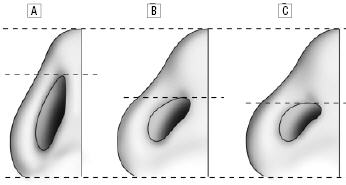 The basal views of the average North American white woman (A), the attractive Korean-American woman (B) and the average Korean-American woman (C).
